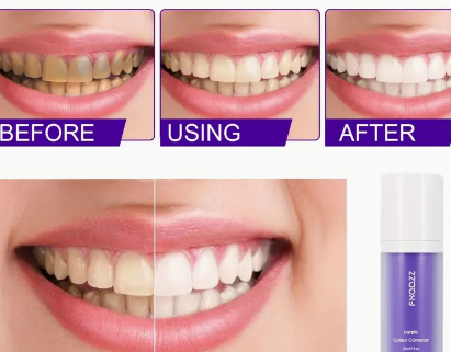 Viral Purple Teeth Whitening Oral Care Paste